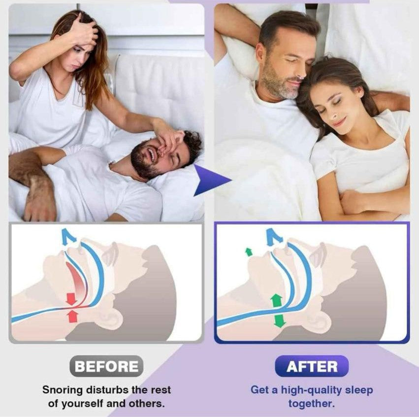 Mobil Lock – Appareil anti-ronflement en silicone médical