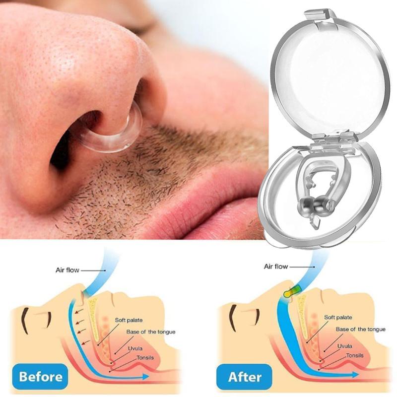 Mobil Lock – Appareil anti-ronflement en silicone médical