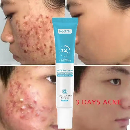 Gel Réparateur Anti-Cicatrices &amp; Anti-Taches – Peau Lisse et Éclatante