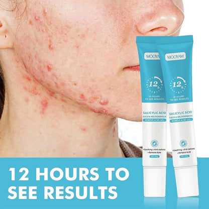 Gel Réparateur Anti-Cicatrices &amp; Anti-Taches – Peau Lisse et Éclatante